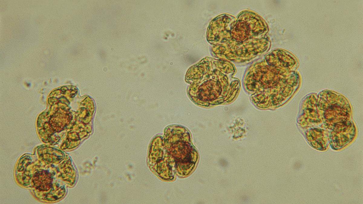 Florida red tide cells are shown under a microscope.PROVIDED PHOTO