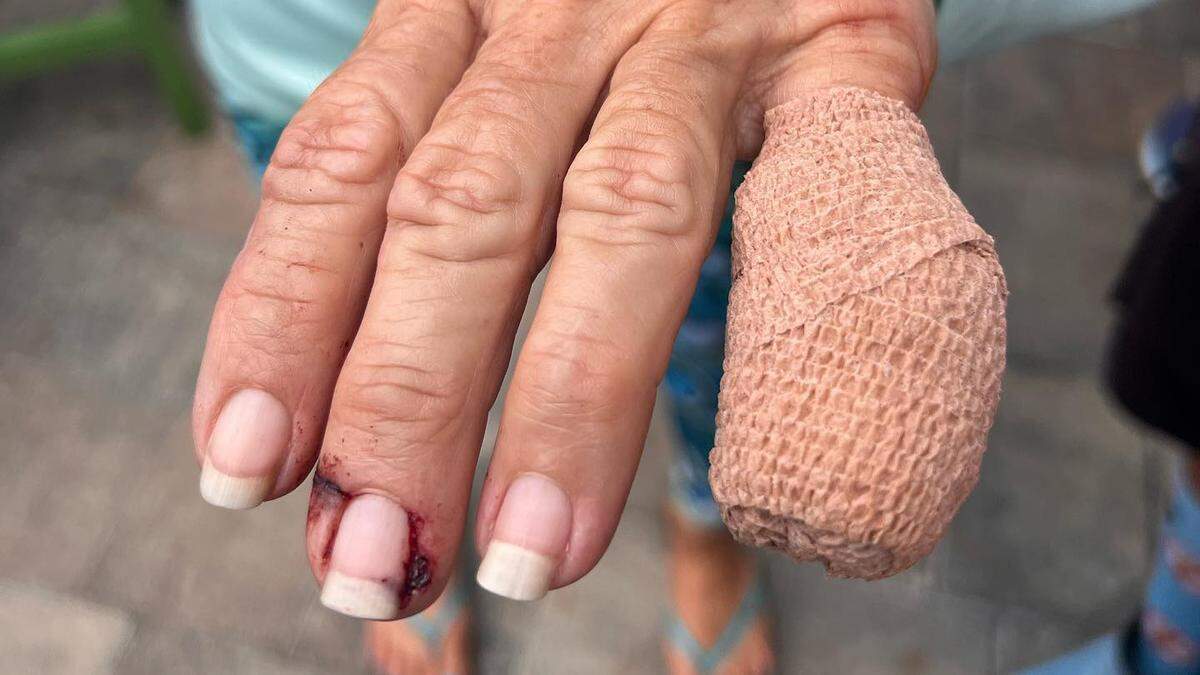 Leiza Fitzgerald was taken to the hospital after her fingers got caught in the fishing line during a tarpon fishing tournament in Tampa Bay.