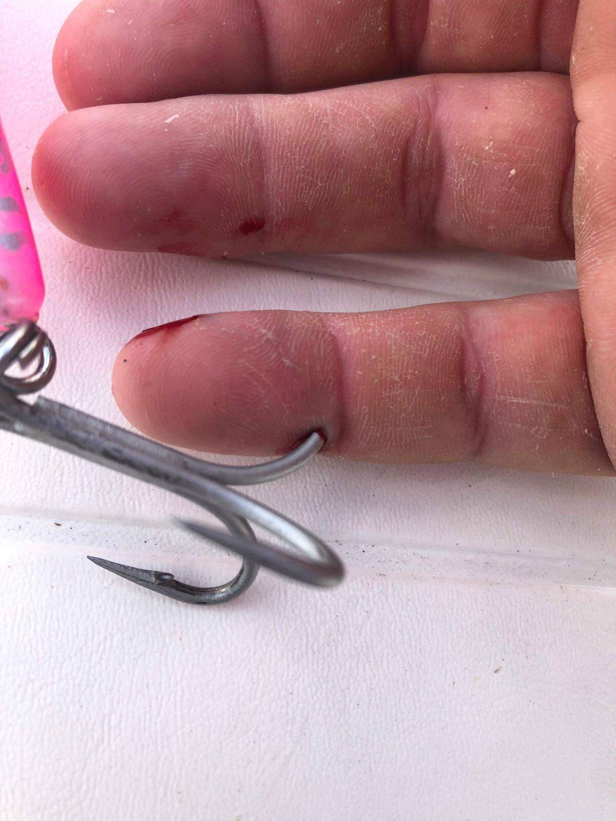 Capt. Griffin Deans had to make a trip to Urgent Care after getting a hook stuck in his finger on a recent fishing trip.