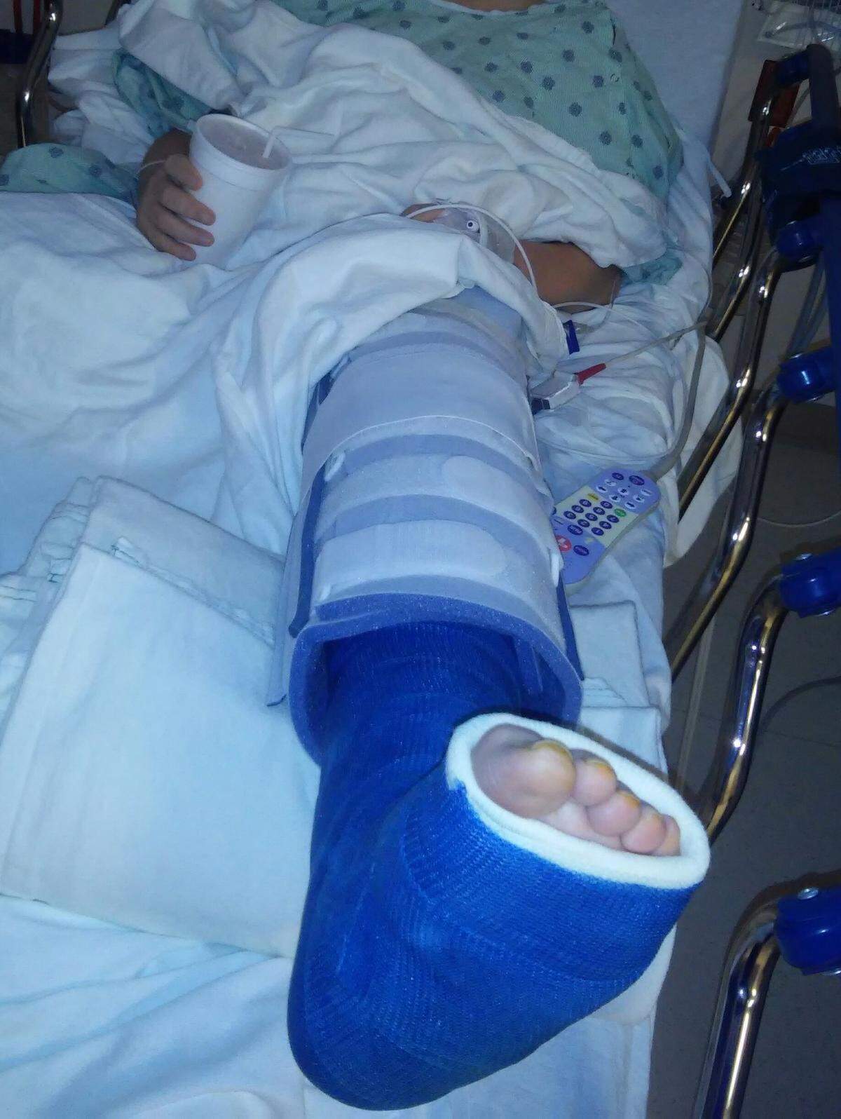 Lovina and Joe’s youngest son Kevin had surgery on his leg this week and must wear a cast for 6-8 weeks.