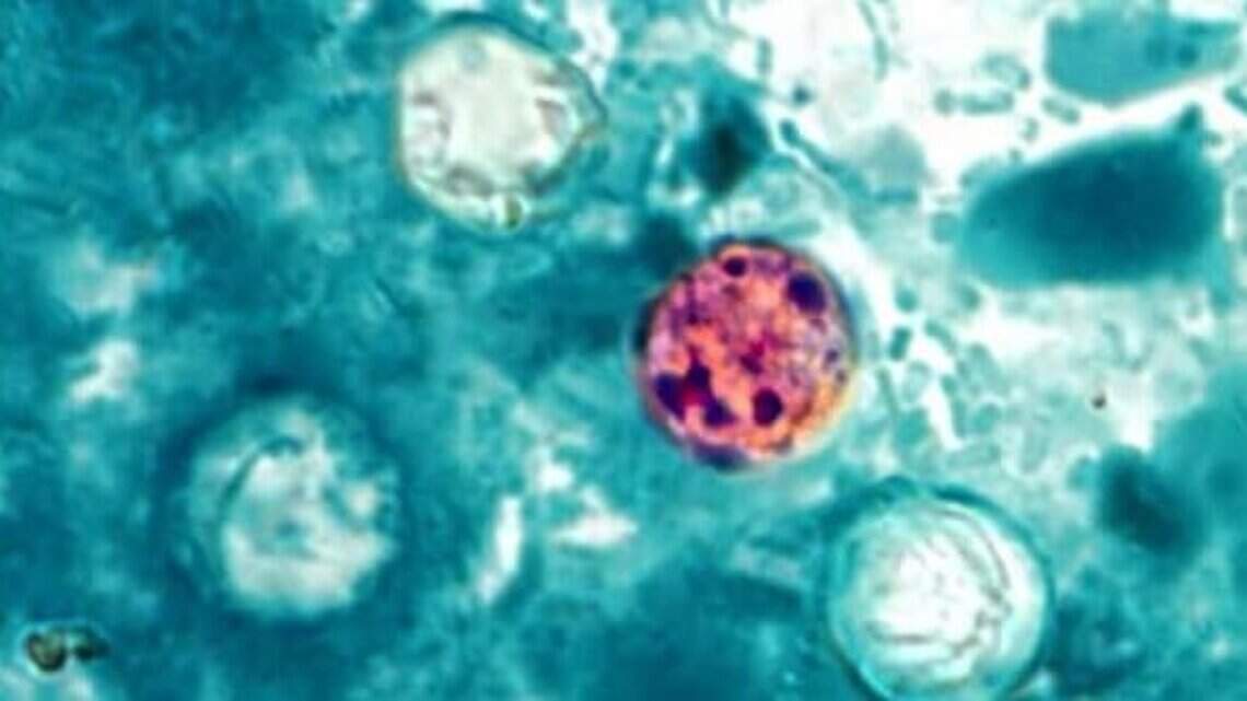 NC’s diarrhea parasite cases: DHHS offers an update regarding possible source