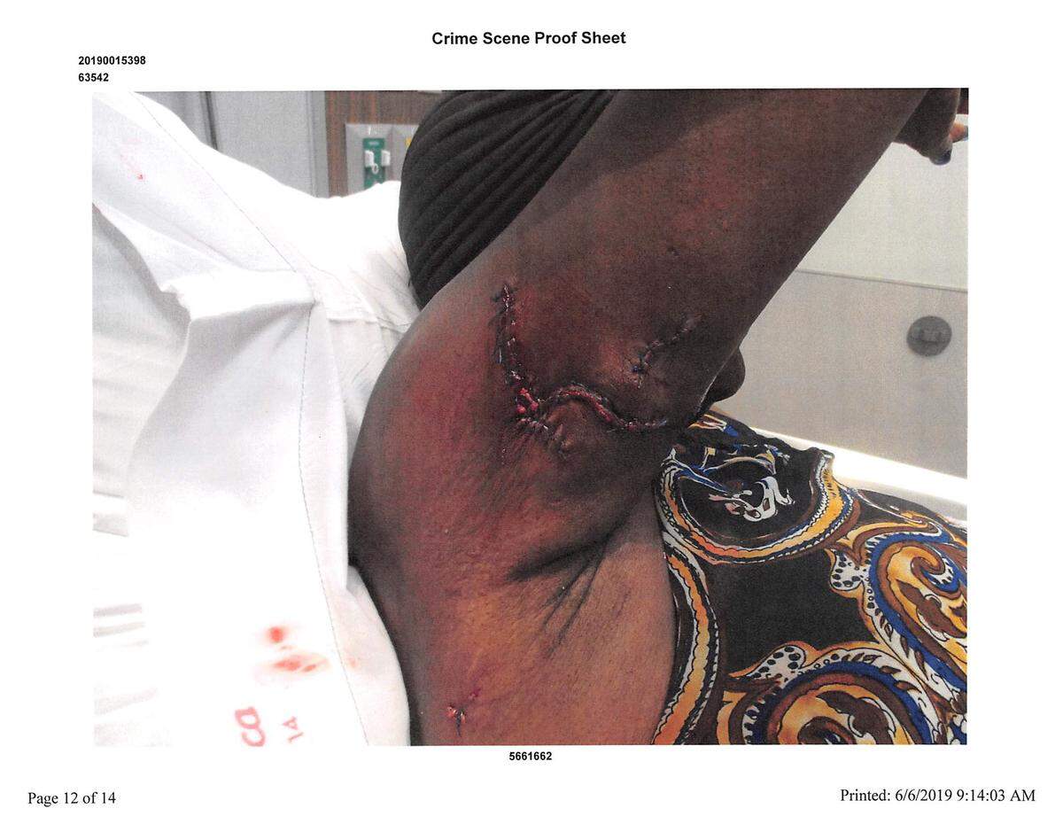 A Bradenton woman received more than 30 stitches after being bit by a K9 when a Manatee County Sheriff’s Office deputy failed to control the dog, an internal affairs investigation concluded.