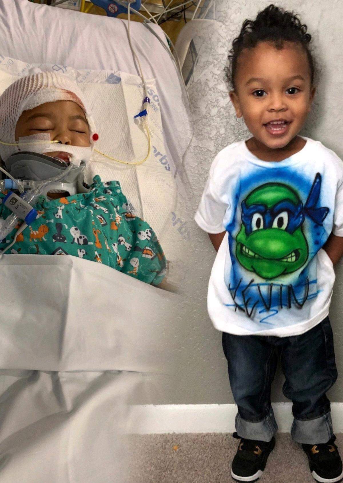 Kevin Smith Jr. was attacked by one of his family’s pit bulls on Saturday afternoon, the day before his third birthday. As shown on the left, K.J., as his family calls him, lost 75 percent of his scalp after being mauled by the dog and remains hospitalized.